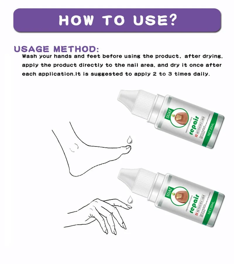 Nail Fungal Treatment Feet Care Essence Nail Foot Toe Nail Fungus Removal Gel Anti Infection Paronychia Onychomycosis